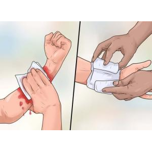 3. Kỹ năng sơ cứu vết thương chảy máu