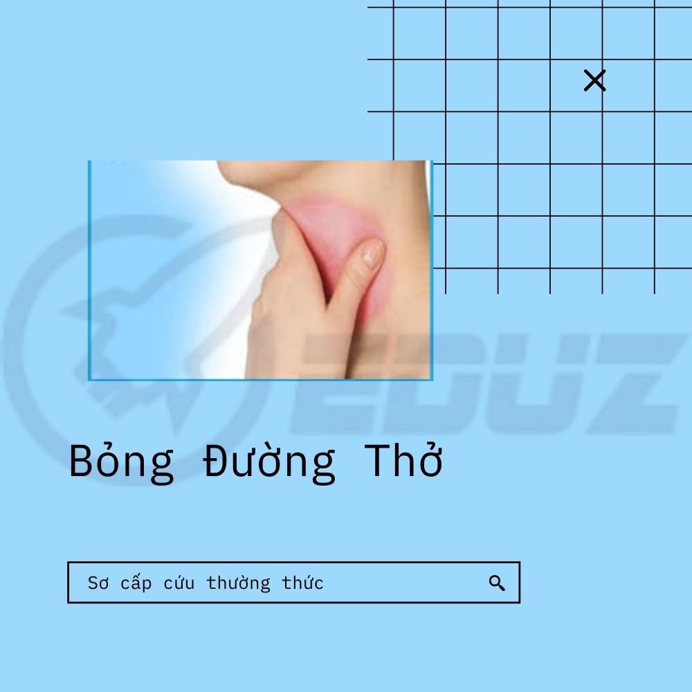 Bỏng Đường Thở