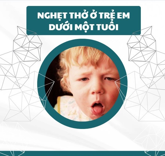 Nghẹt Thở ở Trẻ Em: Trẻ Dưới Một Tuổi