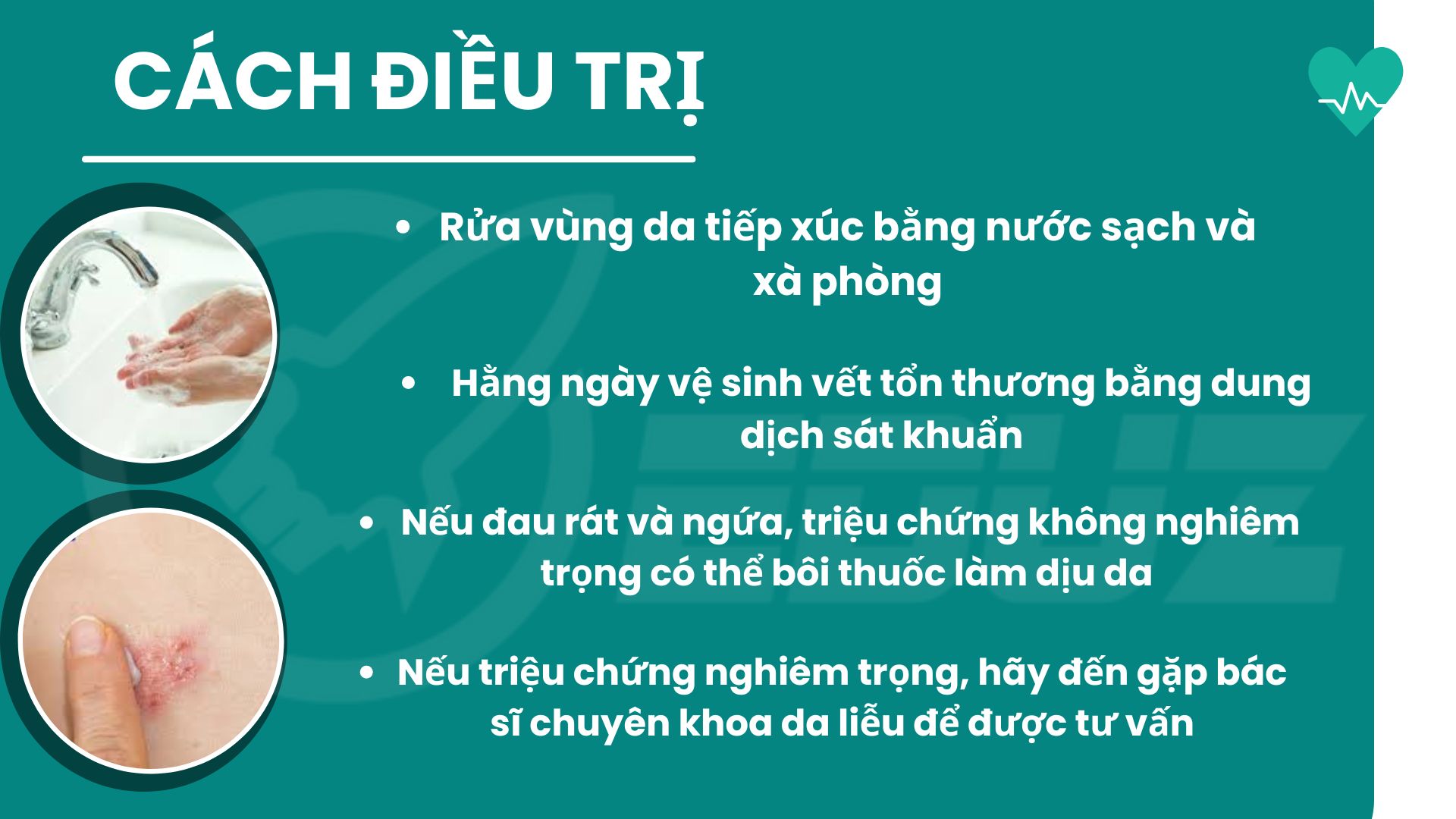 3.Cách điều trị bệnh hiệu quả