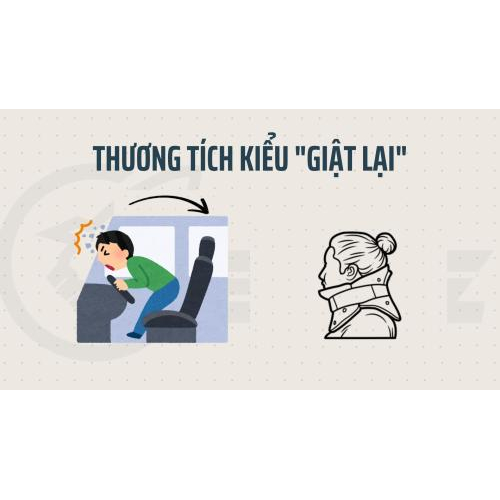 3. Thương tích kiểu "giật lại":