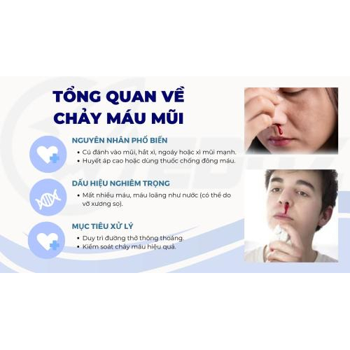 1. Tổng quan về chảy máu mũi