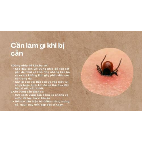 2. Cần làm gì khi bị cắn