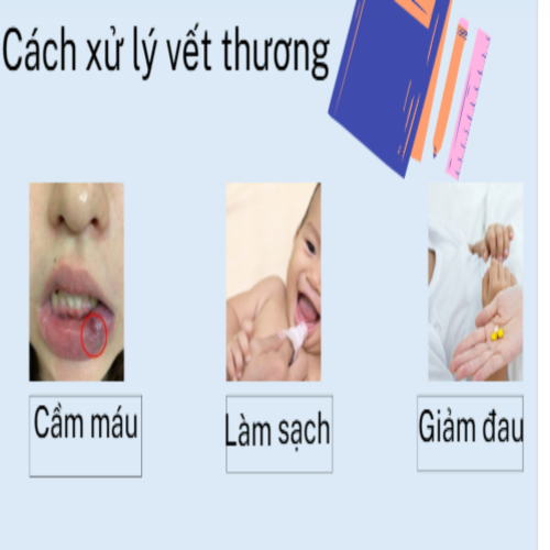 2.Cách xử lý vết thương trong miệng