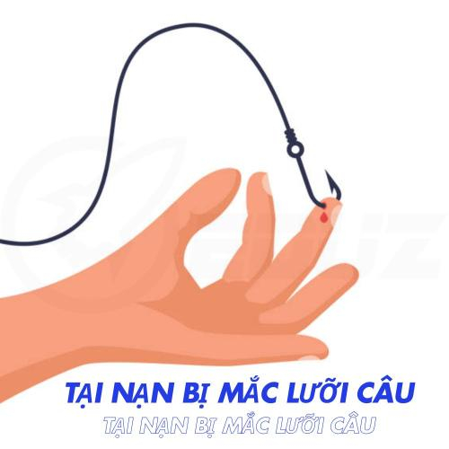 Tai Nạn Bị Móc Lưỡi Câu