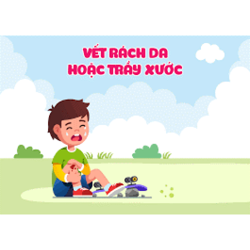 Sơ Cứu Ban Đầu Cho Trẻ Sơ Sinh Và Trẻ Em