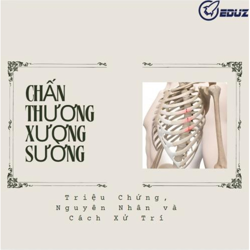 Chấn Thương Xương Sườn: Nhận Biết, Xử Trí Và Phòng Ngừa Hiệu Quả