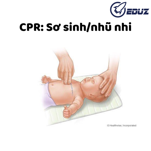 Sơ Cứu Ban Đầu Cho Sơ Sinh Và Trẻ Em: CPR Nhũ Nhi