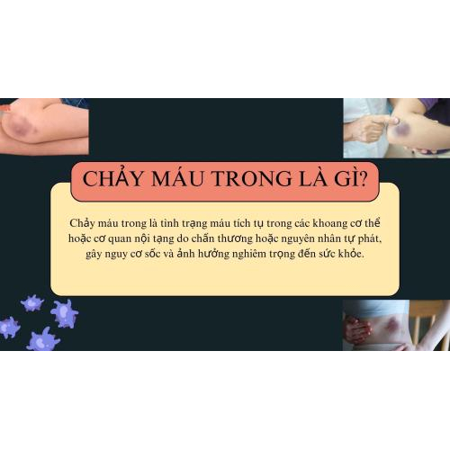 1.Chảy máu trong là gì?