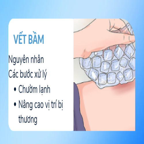 2.Vết bầm