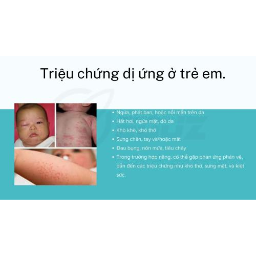 3. Triệu chứng dị ứng ở trẻ em.