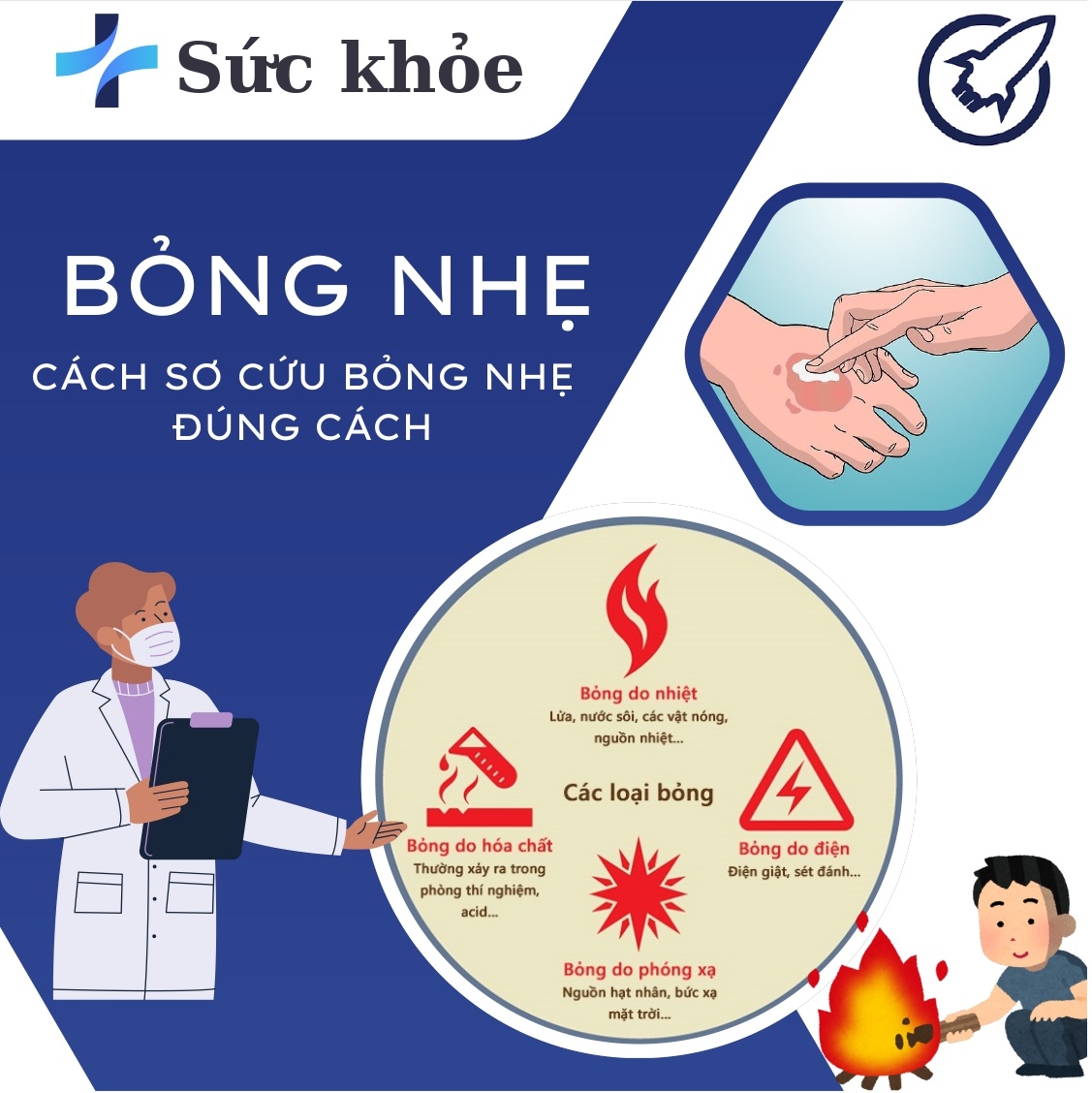 Cách Sơ Cứu Khi Bị Bỏng Nhẹ