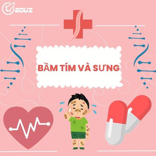 Bầm Tím Và Sưng