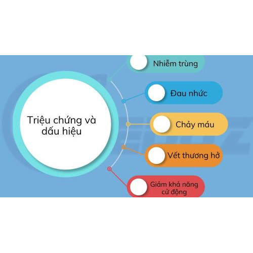 4.Triệu chứng và dấu hiệu