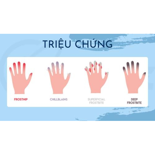 3. Triệu Chứng Nhận Biết Bỏng Lạnh