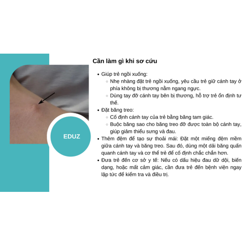 2. Cần làm gì khi sơ cứu