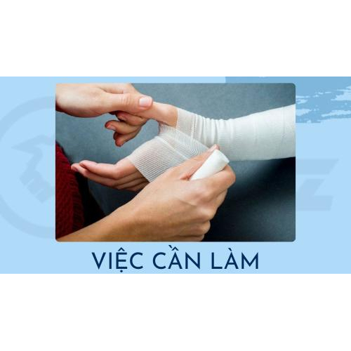 4. Việc Cần Làm Khi Gặp Người Bị Bỏng Lạnh