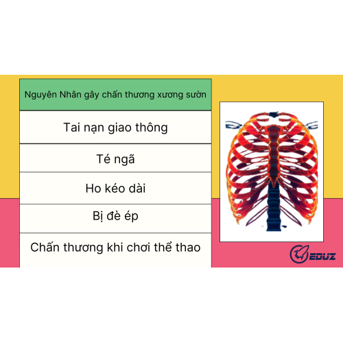 2. Nguyên nhân chấn thương xương sườn