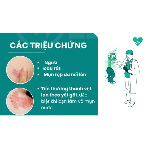 2.Các triệu chứng của bệnh