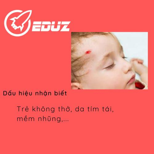 Sơ Cứu Trẻ Sơ Sinh Ngừng Thở