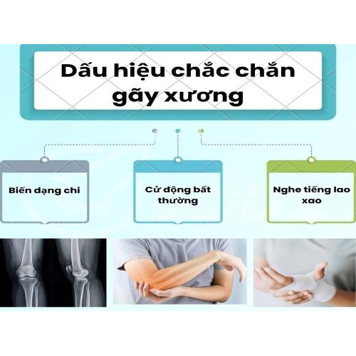 2. Dấu hiệu chắc chắn gãy xương