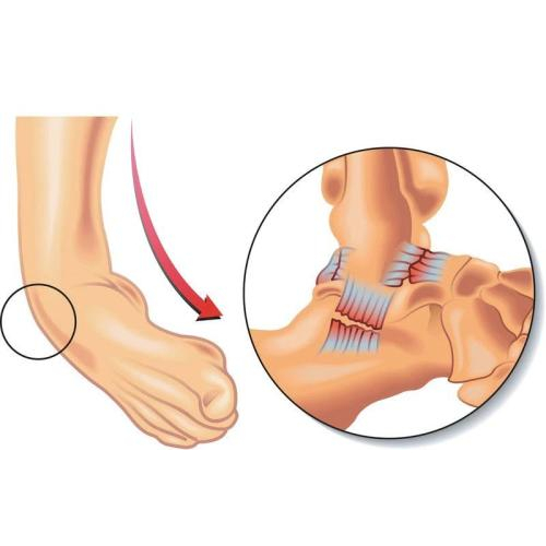 4. Tầm quan trọng của việc xử lý chấn thương kịp thời